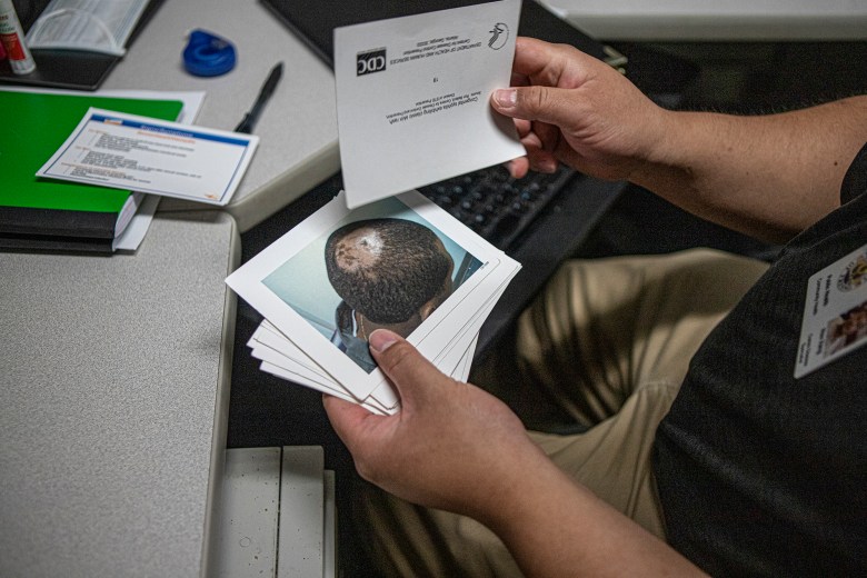 Hou Vang shows the postcards he carries to show people what syphilis symptoms can look like on June 9, 2022. Photo by Larry Valenzuela, CalMatters/CatchLight Local