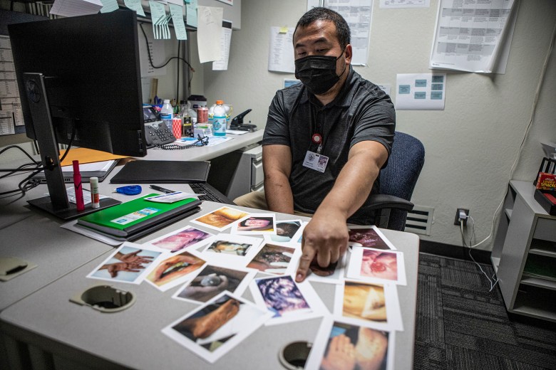 Hou Vang shows the postcards issued by the U.S. Centers for Disease Control with pictures of syphilis symptoms he carries to show patients what syphilis symptoms can look like on June 9, 2022. Photo by Larry Valenzuela, CalMatters/CatchLight Local